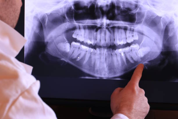 Best Emergency Dental Care for Broken or Chipped Teeth in Ashland, MO