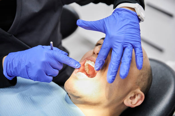 Best Emergency Treatment for Dental Infections or Abscesses in Ashland, MO